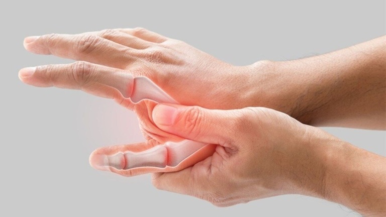 Arthritis: ठंड में उभरने लगता है गठिया का दर्द! राहत के लिए अपनाएं ये सरल उपाय