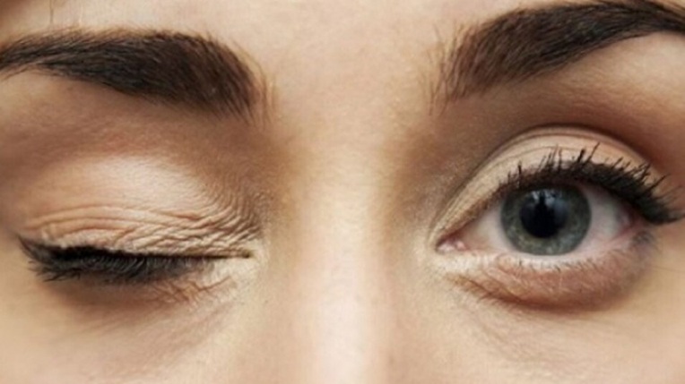 Eye twitching: अपशगुन नहीं! शरीर में इन चीजों की कमी से फड़कती हैं आंखें