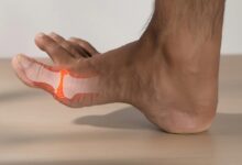 Health Tips: यूरिक एसिड बढ़ने से बढ़ गया जोड़ों का दर्द? जानें इसको कंट्रोल करने के सरल उपाय