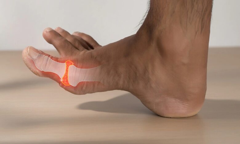 Health Tips: यूरिक एसिड बढ़ने से बढ़ गया जोड़ों का दर्द? जानें इसको कंट्रोल करने के सरल उपाय