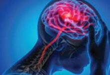 Alert! देश में तेजी से बढ़ रहीं न्यूरोलॉजिकल बीमारियां, बढ़ रहे मस्तिष्क रोग के मरीज