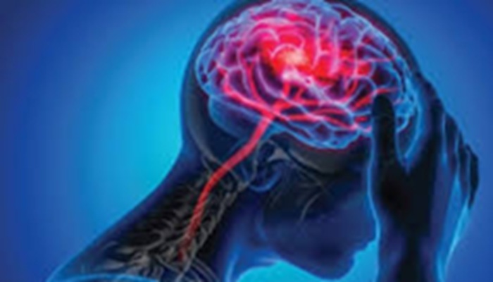 Alert! देश में तेजी से बढ़ रहीं न्यूरोलॉजिकल बीमारियां, बढ़ रहे मस्तिष्क रोग के मरीज