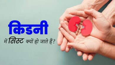 kidney cysts: किडनी में सिस्ट होना क्या है? क्या हैं इसके कारण, कैसे होता है उपचार, जान लें