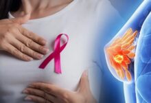 Breast Cancer:: युवा महिलाओं में क्यों बढ़ रहा ब्रेस्ट कैंसर? ये शुरुआती लक्षण अक्सर किए जाते हैं नजरअंदाज