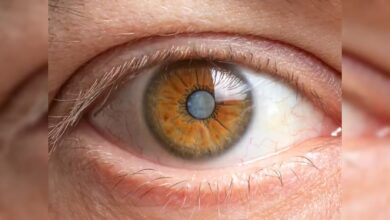 Glaucoma: आंखों का 'साइलेंट किलर' है ग्लूकोमा, जानिए कैसे नज़रों को हैं बचाना?