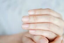 Health Tips: नाखूनों में होने वाले बदलाव हो सकते हैं इन गंभीर बीमारियों के संकेत