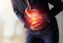 Digestion: रहता है पेट खराब? डाइट और लाइफस्टाइल में कर लें ये बदलाव, सही हो जाएगा डायजेशन