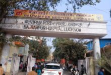 Lucknow: बलरामपुर चिकित्सालय में छह माह की बच्ची का जटिल जन्मजात रोग का सफल ऑपरेशन