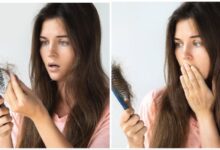 Hair Loss: बाल झड़ने से हैं परेशान, अपनाएं ये आसान घरेलू उपाय