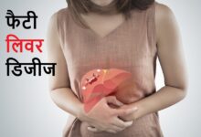 Fatty Liver Disease: कहीं आप भी तो नहीं कर रहे ये 8 गलतियां? फैटी लिवर को दे रहे दावत