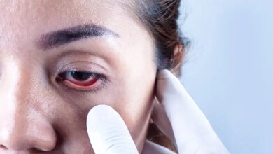 Lucknow: स्थायी अंधत्व का प्रमुख कारण है ग्लूकोमा, नियमित रूप से नेत्र परीक्षण कराना जरूरी