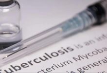 TB: टीबी के शुरुआती लक्षण क्या हैं? कब हो जाना चाहिए सावधान? जानिए सबकुछ