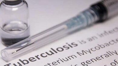 TB: टीबी के शुरुआती लक्षण क्या हैं? कब हो जाना चाहिए सावधान? जानिए सबकुछ