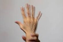 Double Vision: अचानक सब कुछ दिखने लगा है डबल, आपको डिप्लोपिया तो नहीं हो गया?