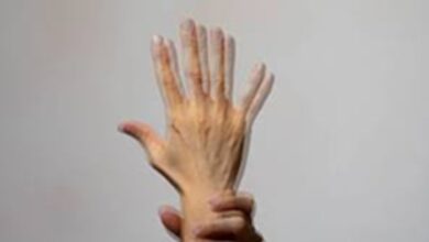 Double Vision: अचानक सब कुछ दिखने लगा है डबल, आपको डिप्लोपिया तो नहीं हो गया?