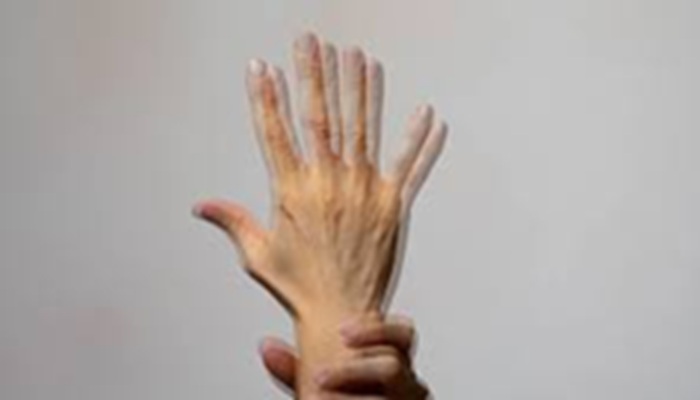 Double Vision: अचानक सब कुछ दिखने लगा है डबल, आपको डिप्लोपिया तो नहीं हो गया?