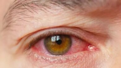 Alert! आंखों के नीचे रहती है सूजन, हो सकती है किडनी से जुड़ी ये बीमारी