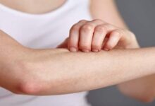 Skin Itching: होती रहती है तेज खुजली, जानें किस विटामिन की कमी से होता है ये
