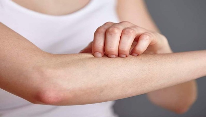 Skin Itching: होती रहती है तेज खुजली, जानें किस विटामिन की कमी से होता है ये