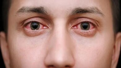 Eyes Care: चिलचिलाती गर्मी से आंखों में होने लगी है जलन? जानिए क्या है इसका सलूशन