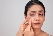 Face Care: महंगी क्रीम लगाने के बाद भी चेहरे से नहीं जा रहे हैं पिंपल, जानिए क्या करें?