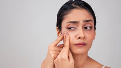 Face Care: महंगी क्रीम लगाने के बाद भी चेहरे से नहीं जा रहे हैं पिंपल, जानिए क्या करें?