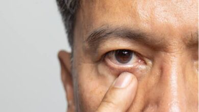 Eye Twitching: बार-बार फड़क रही है आंख? जानें कारण और राहत के उपाय