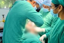 Lucknow Civil Hospital News: सिविल में हुई जटिल सर्जरी, बचा लिया गर्भाशय